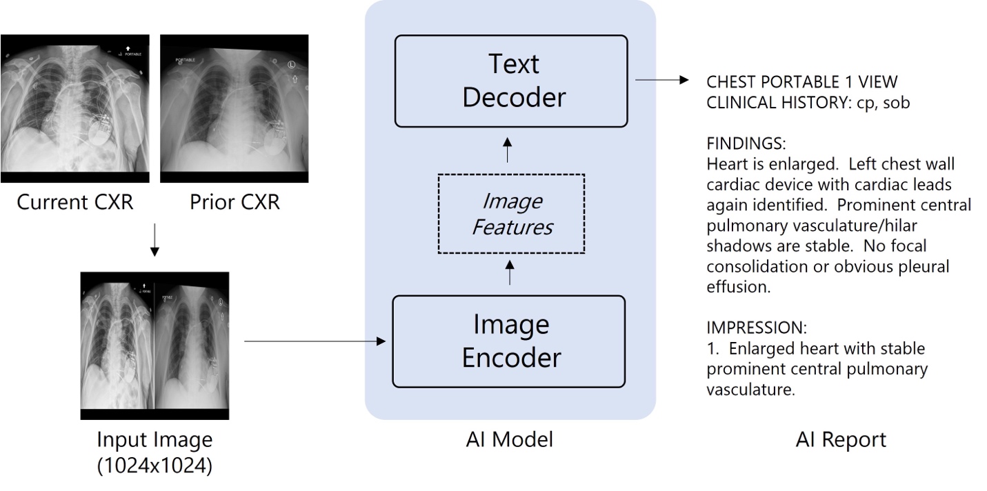 This shows the model architecture of a chest x-ray interpretation. The current and prior x-rays are combined into a single input image, which flows through an AI model including an image encoder and a text decoder, which then outputs the observation and impression.